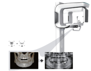 Surrey Vatech-imaging-i3d-Smart-ct-scan