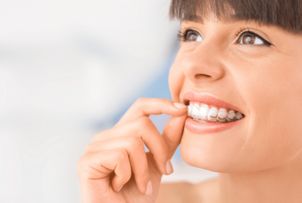 Surrey what you need to know before starting invisalign