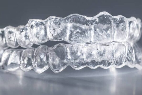 Delta seven tips for the best invisalign results Delta seven tips for the best invisalign results