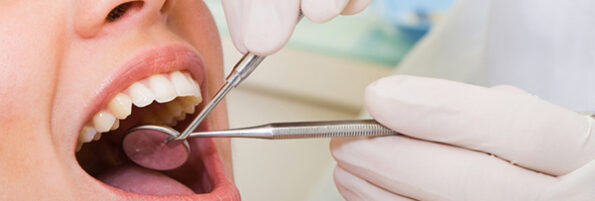 Surrey tooth gems near you Surrey tooth gems near you